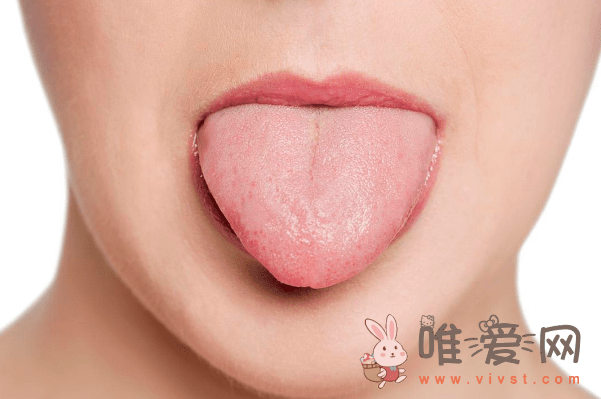 舌苔发黑是什么病症？引起舌苔发黑的因素有哪些？